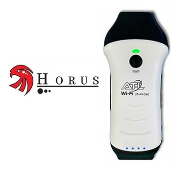 Horus Wireless Ultrasound Probe