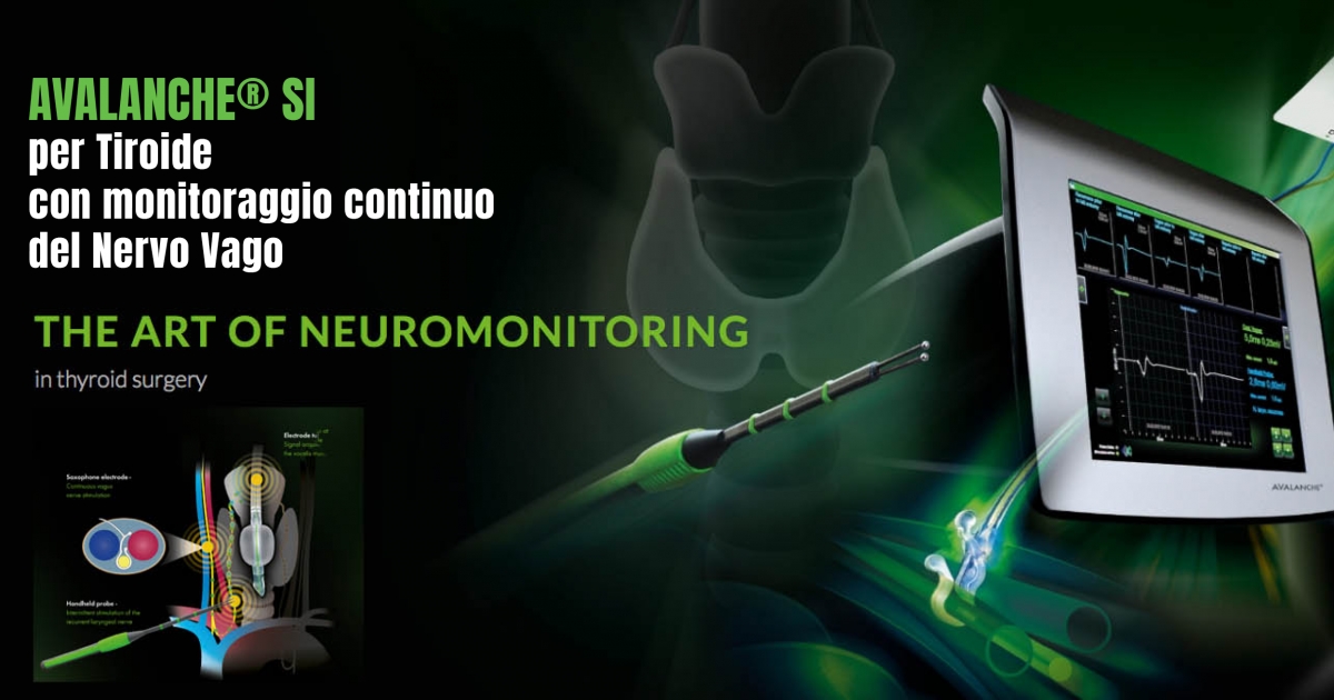 Sistema per neuromonitoraggio intraoperatorio per chirurgia tiroidea e paratiroidea