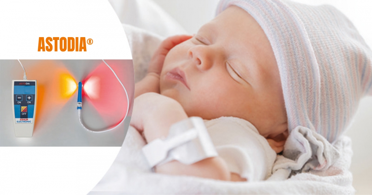 Come semplificare l'accesso vascolare per i piccoli pazienti prematuri e neonati