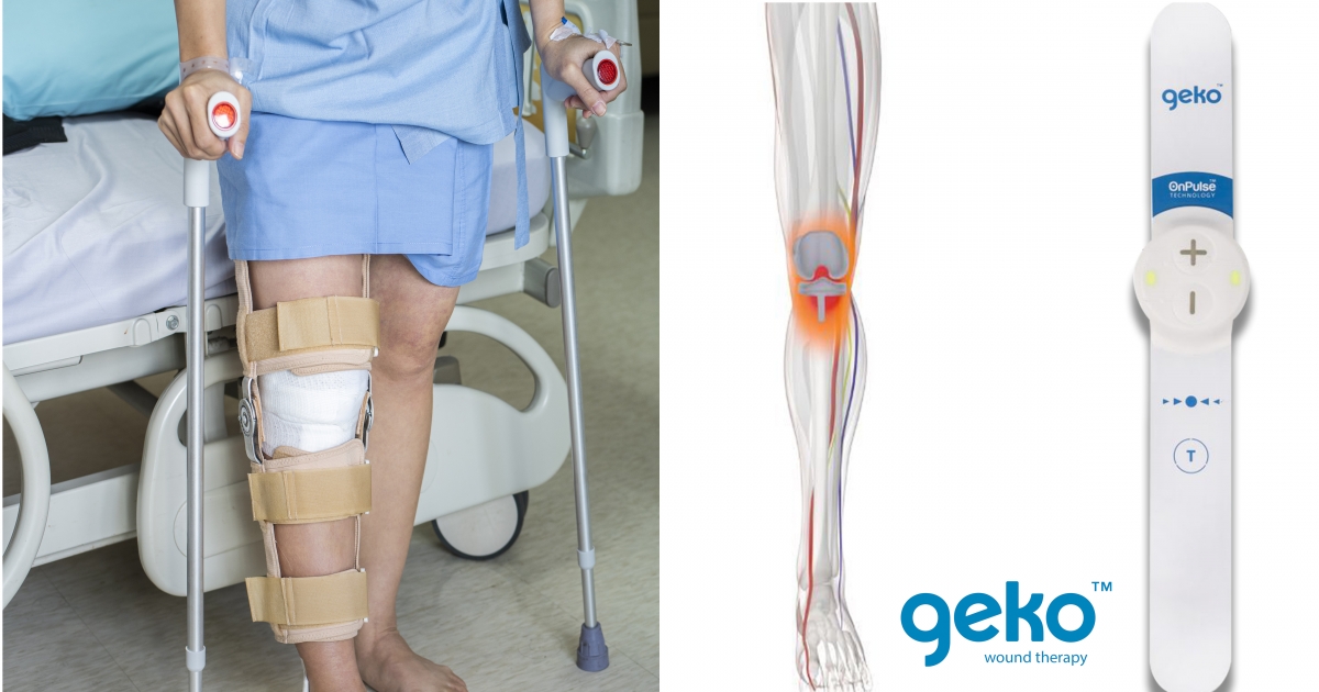 Cosa fare dopo la chirurgia sostitutiva del ginocchio?