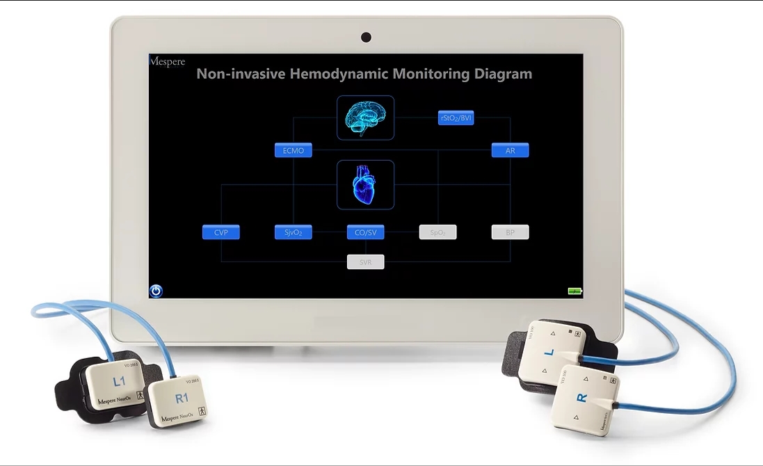 Non-Invasive & Continuous Hemodynamic Monitoring