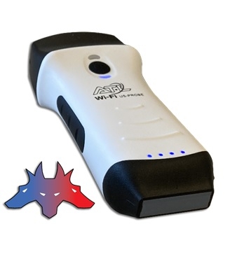 Cerbero 4 Sonda Ecografica Wireless
